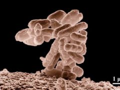 Un amas de bactéries Escherichia Coli grossi 10,000 fois. Eric Erbe-wikipedia