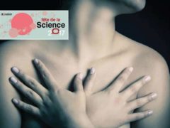 Un essai est lancé dans 12 hôpitaux, en France, pour traiter par ultrasons des fibroadénomes (grosseurs bénignes) du sein. Shutterstock
