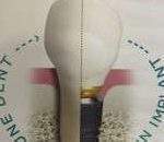 Implants dentaires en 3D (Photo U.L.)
