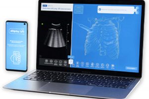 Manipuler une sonde échographique avec son téléphone (InSimo)