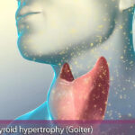 glande-thyroïde (UnlimPhotos)