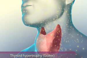 glande-thyroïde (UnlimPhotos)