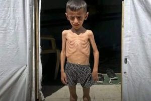 Les enfants de Gaza meurent de faim (UNRWA)