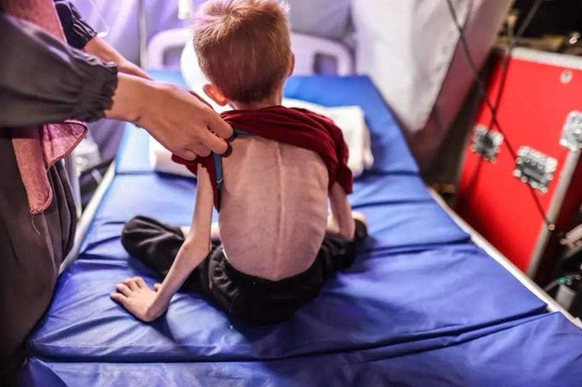 À Gaza, les enfants meurent de faim (UNRWA)