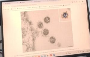 Image par microscopie électronique du SARS-CoV-2 étudié à Wuhan (DR)