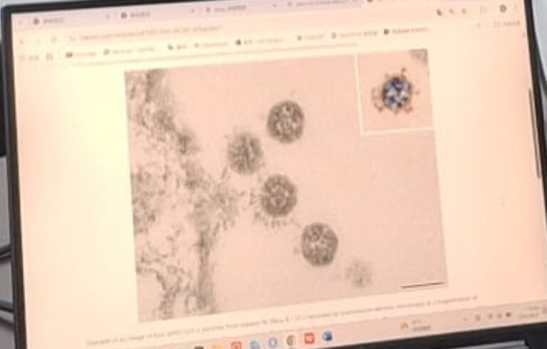 Image par microscopie électronique du SARS-CoV-2 étudié à Wuhan (DR)