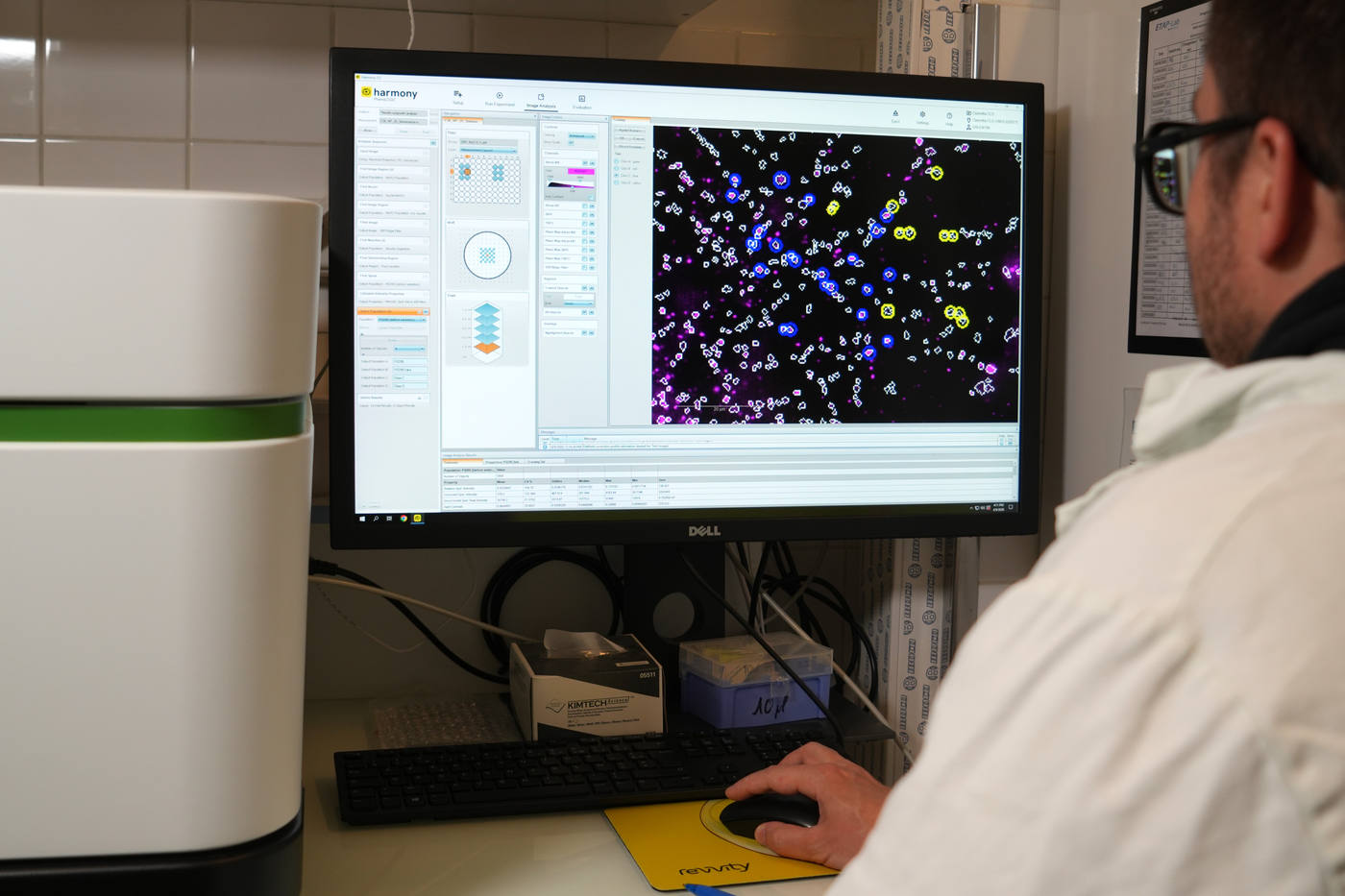 Plateforme-inVitro-resultats-en-High-Content-imaging-avec-IA-credit-Etap-Lab